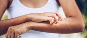 acupunctuur-eczeem-jeuk