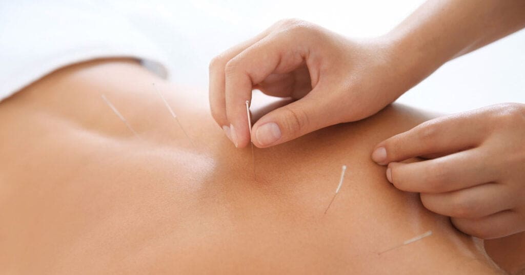 acupunctuur-rotterdam-slaapproblemen