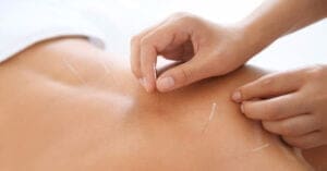 acupunctuur-rotterdam-slaapproblemen